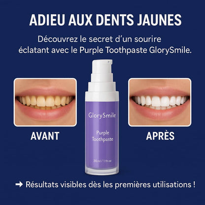 GLORYSMILE – Un sourire éclatant dès la première utilisation